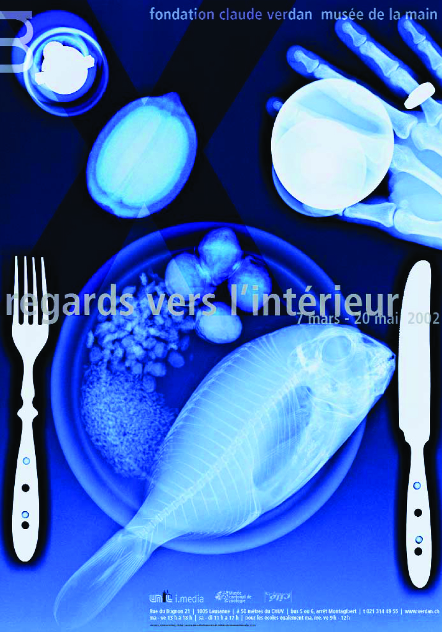 Cliché: Service de radiodiagnostic et radiologie interventionnelle CHUV. Graphisme: www.atelierk.ch Cliché: Service de radiodiagnostic et radiologie interventionnelle CHUV. Graphisme: www.atelierk.ch